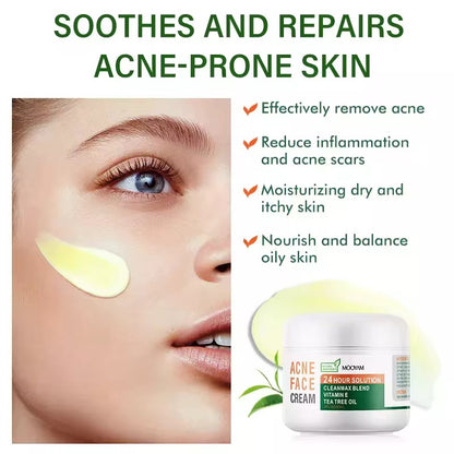 Acne face cream Lëkurë e pastër pa akne – që në ditët e para