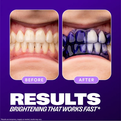 HiSMILES instantly Whiten Teeth, Deeply Clean & Remove Stains, and Freshen Breath