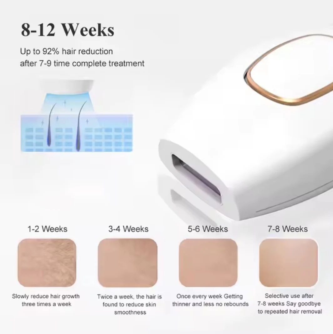 Laser IPL pajisje për heqjen e qimeve